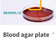 کلچر میڈیم بلڈ آگر پلیٹس (9 سینٹی میٹر) استعمال کرنے کے لیے تیار ہے جو عام بیکٹیریا کے الگ تھلگ کلچر اور ہیمولیسس ٹیسٹ کے لیے استعمال ہوتا ہے